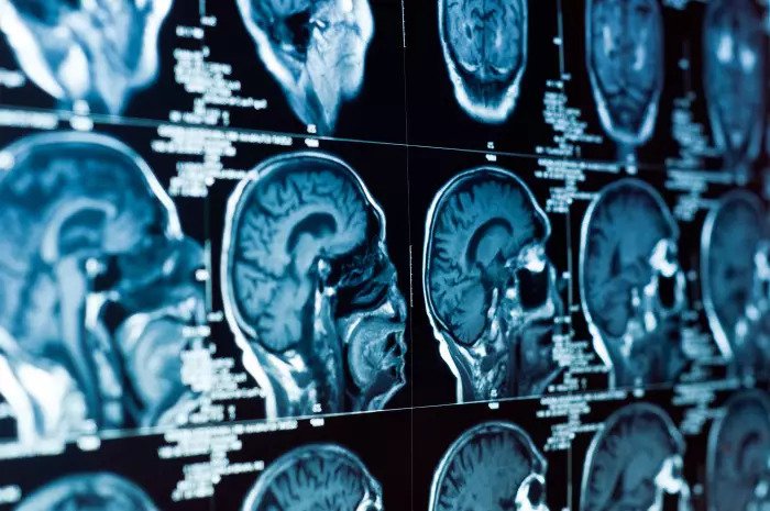 Компьютерная томография черепа и мозга
