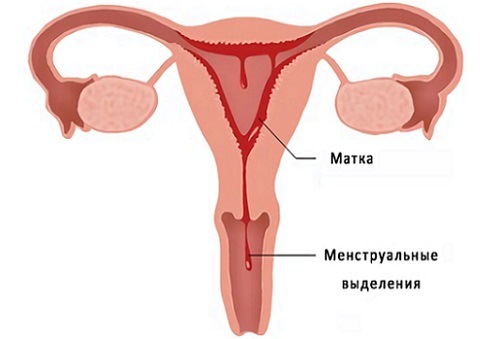 Обильные месячные при беременности, матка, менструальные выделения