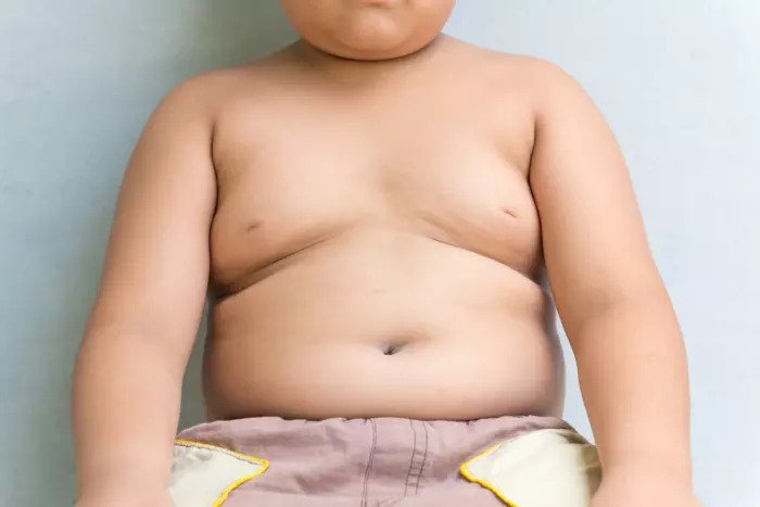 Ребенок, страдающий ожирением и мужской грудью