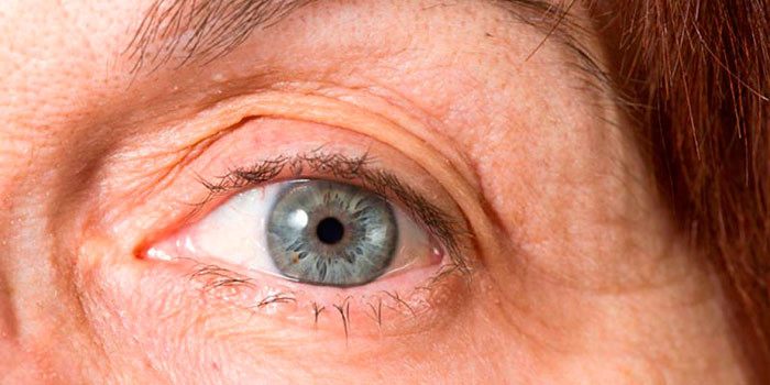 Осложнения после операции по замене хрусталика глаза