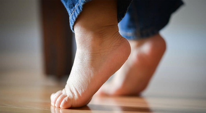 Почему ребенок ходит на носочках: норма или патология