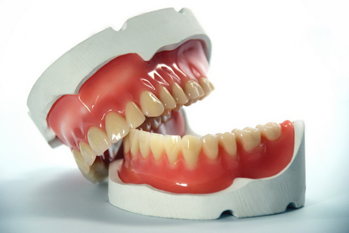 Корректировка зубного ряда нижней челюсти
