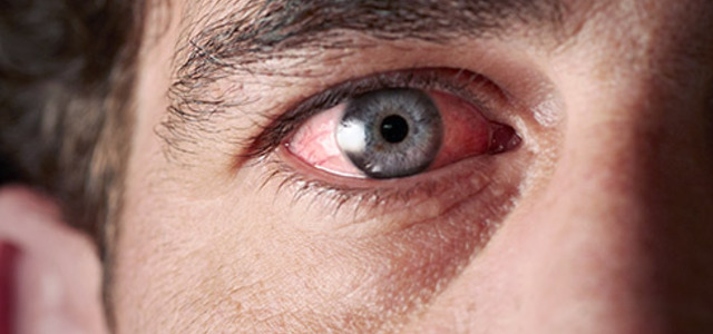 Переход инфекции из глаза