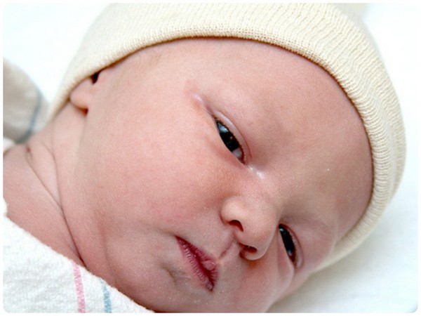 Что делать при признаках нагноения глаз у новорожденного