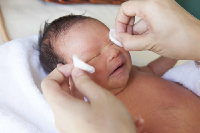 Зондирование слезного канала у новорожденных