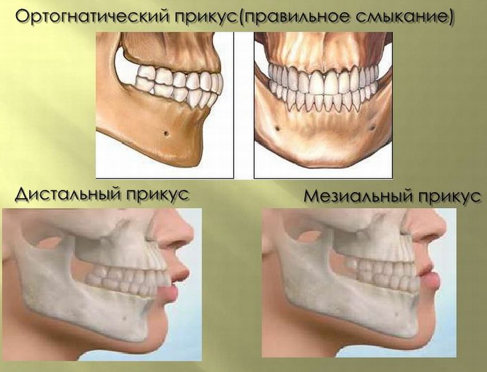 Правильное положение зубов человека