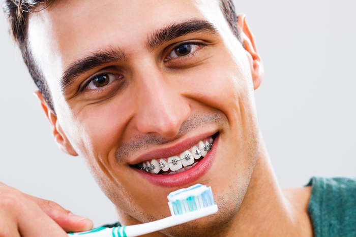 Как чистить зубы с установленными брекетами