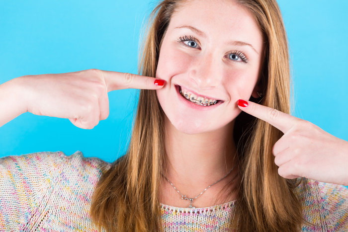 Как брекеты снимаются с зубов?